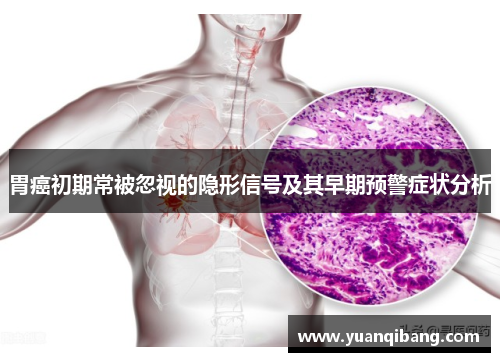 胃癌初期常被忽视的隐形信号及其早期预警症状分析