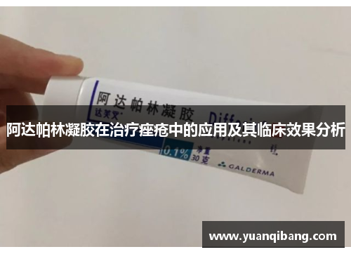 阿达帕林凝胶在治疗痤疮中的应用及其临床效果分析